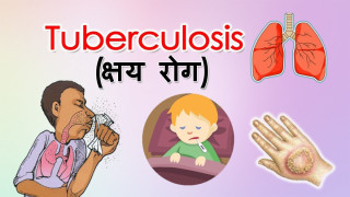 कहाँ हराए क्षयरोगका ४० हजार बिरामी ?